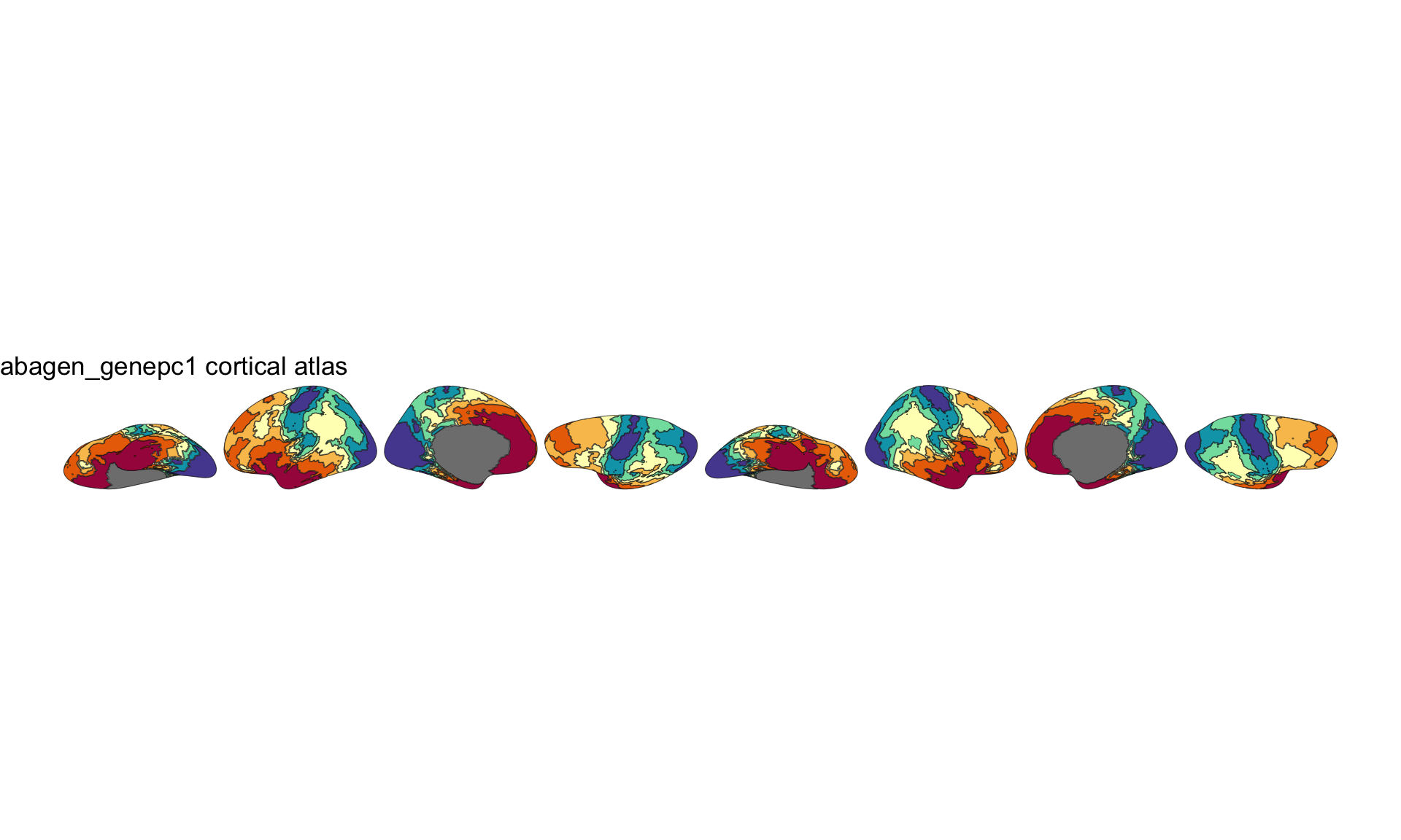 2D brain atlas plot showing gene expression quantile bins across lateral, medial, inferior, and superior views without legend.