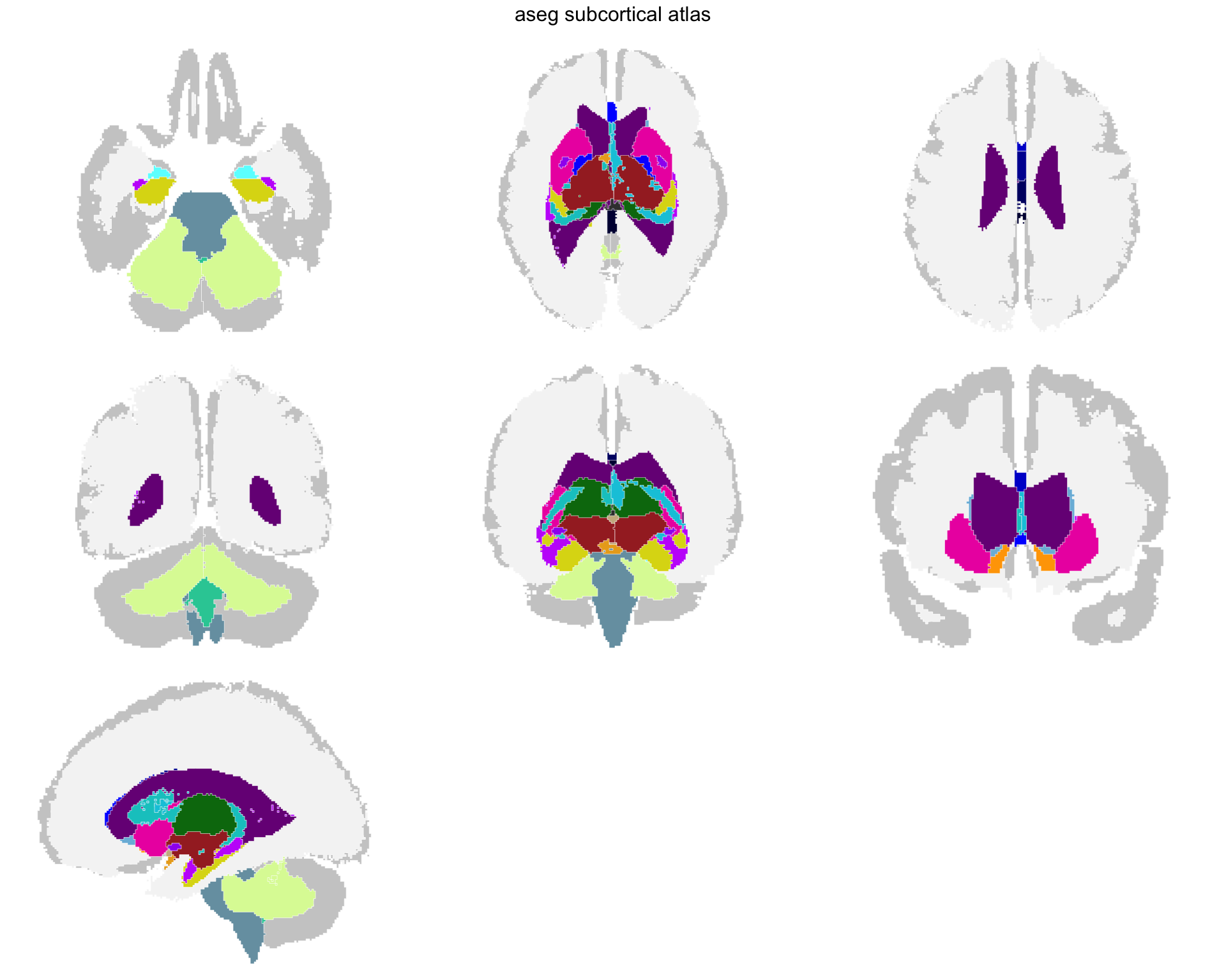 The full aseg segmentation across all seven projection views, every region filled, including white matter and ventricles, with the cortex in grey behind them.