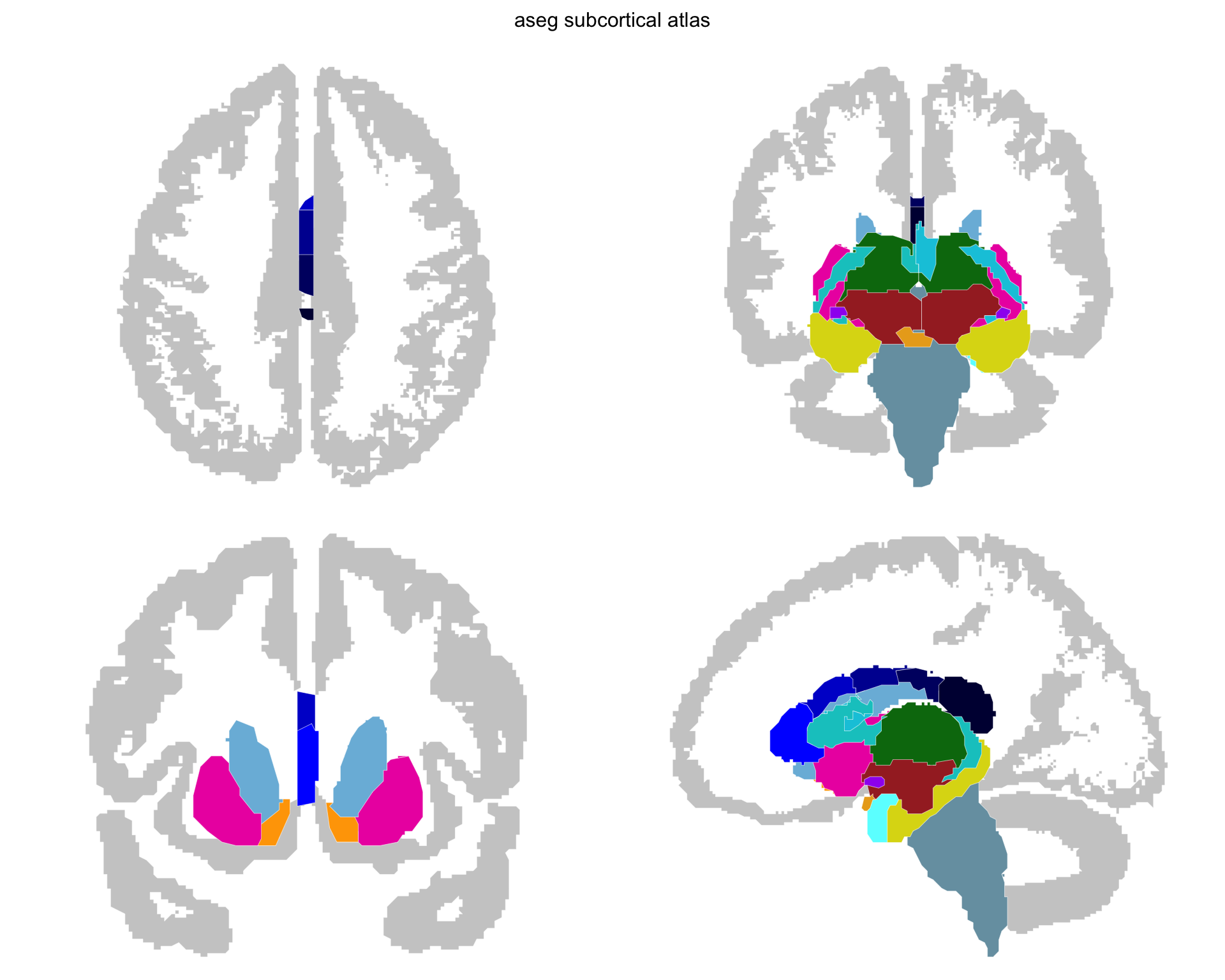 The same four views after simplification, with fewer vertices and straighter but still angular outlines on both the structures and the cortex silhouette.