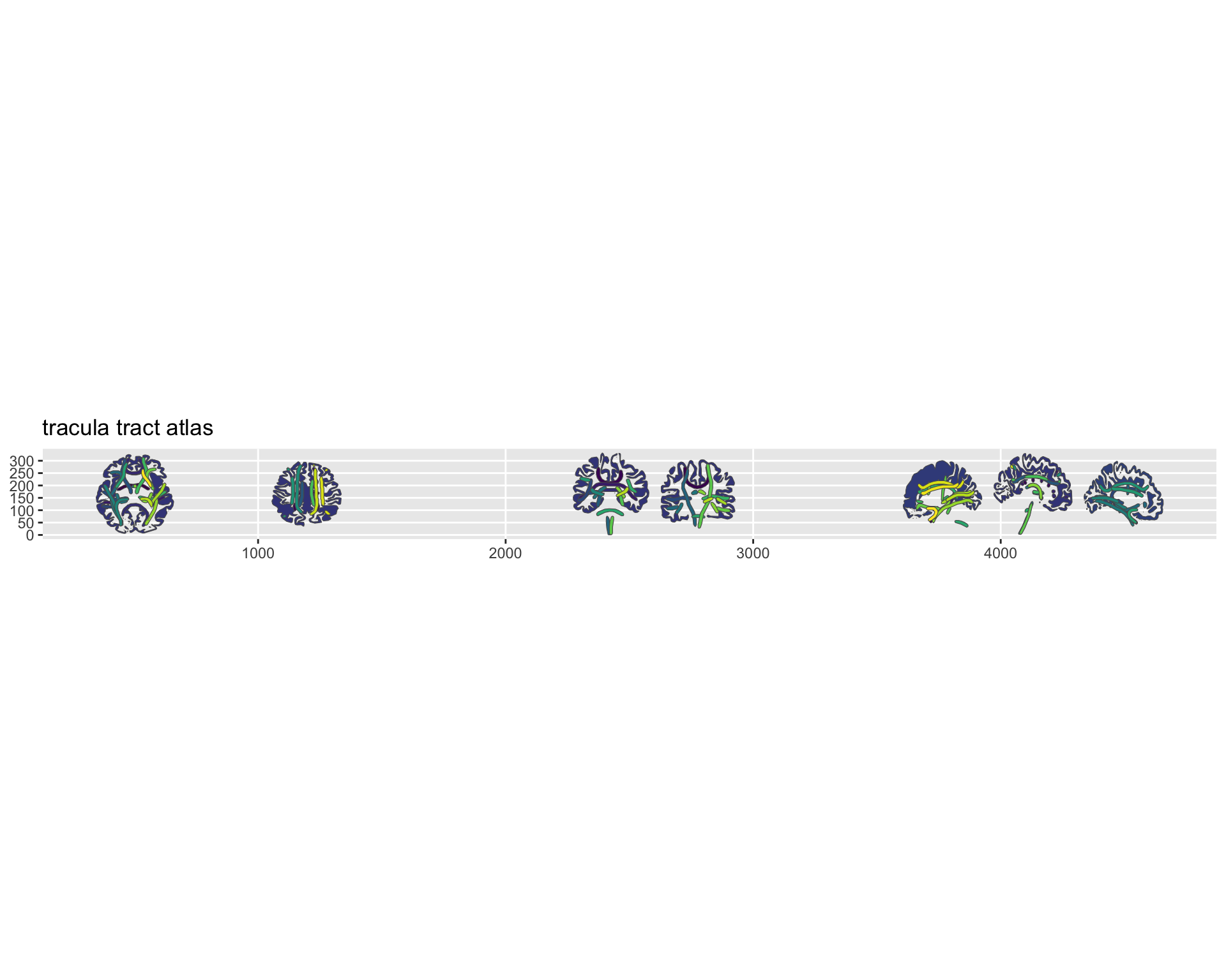 2D brain atlas plot showing white matter tracts including corticospinal tract, uncinate fasciculus, and cingulum across axial, coronal, and sagittal projection views.
