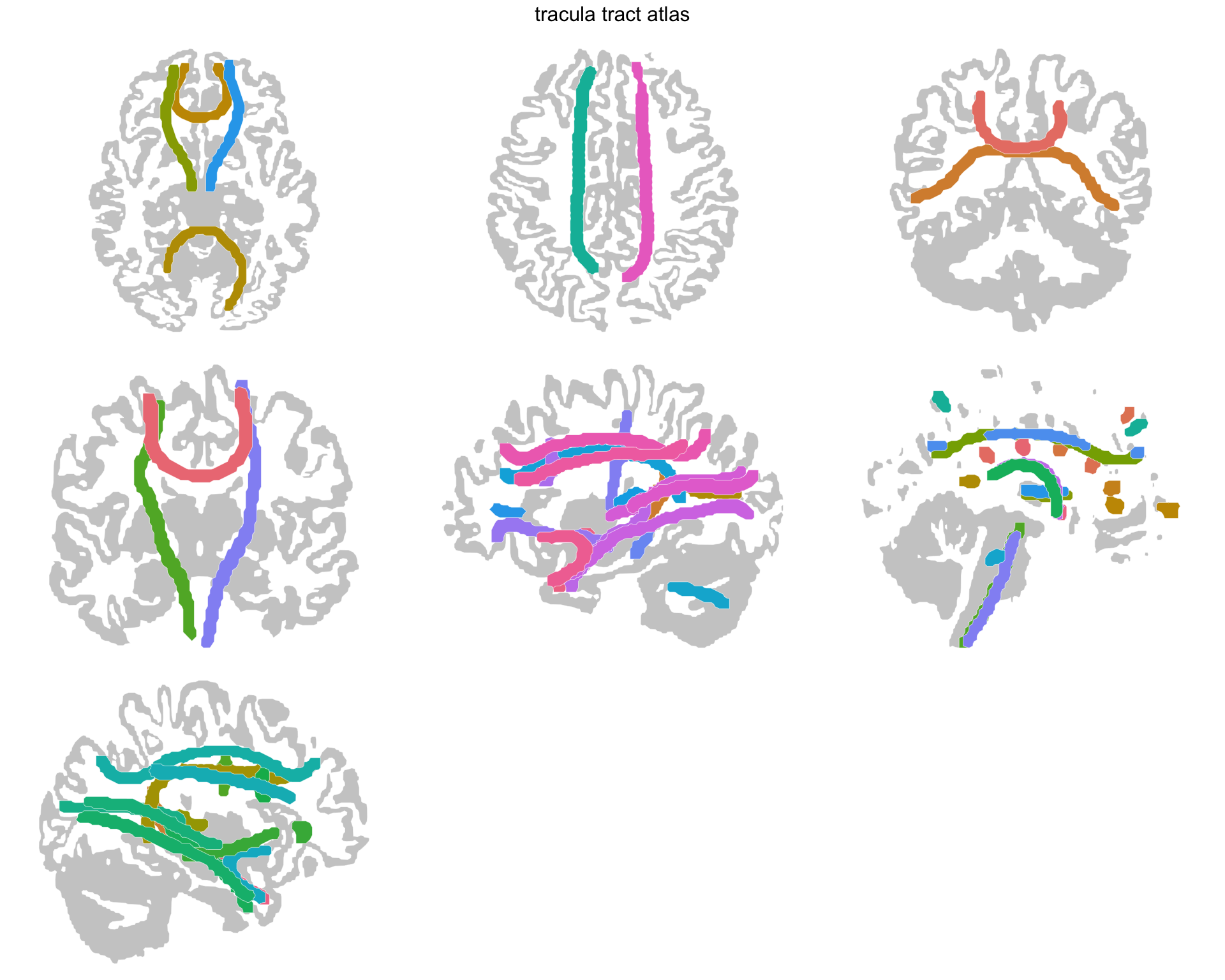 The same seven views with the tracts drawn as smooth tapering bands and a cortex silhouette that still shows its sulci.