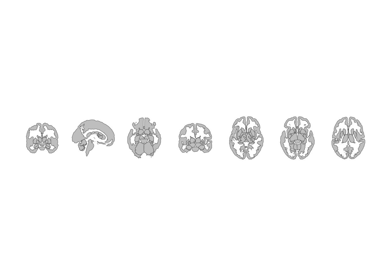 Subcortical atlas views arranged horizontally.