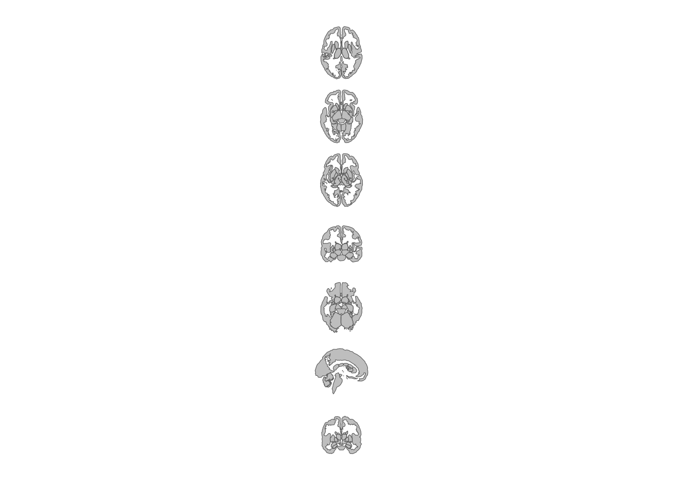 Subcortical atlas views arranged vertically.