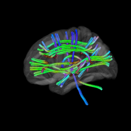 Tracts coloured by fibre orientation — red, green, and blue channels encoding direction — against a black background in rgl.