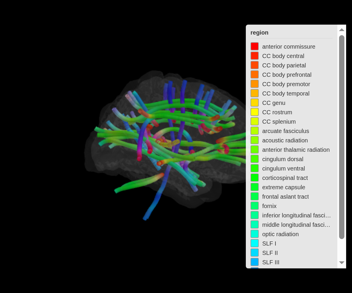 Tracts coloured by fibre orientation — red for left-right, green for anterior-posterior, blue for superior-inferior — against a black background.