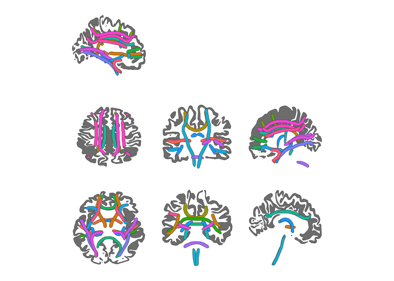 2D visualization of white matter tracts