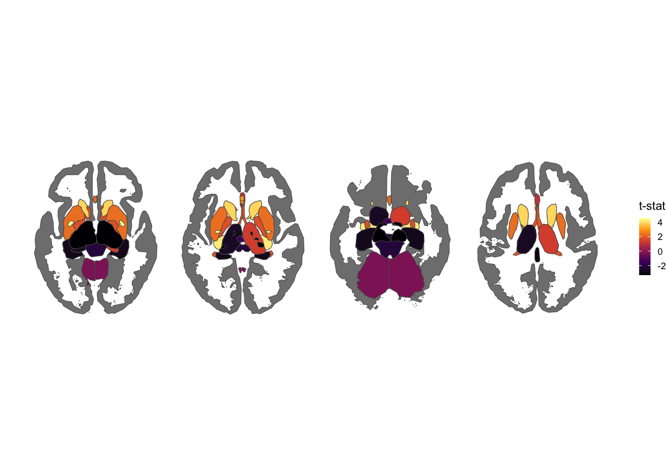 aseg atlas, axial views, inferno