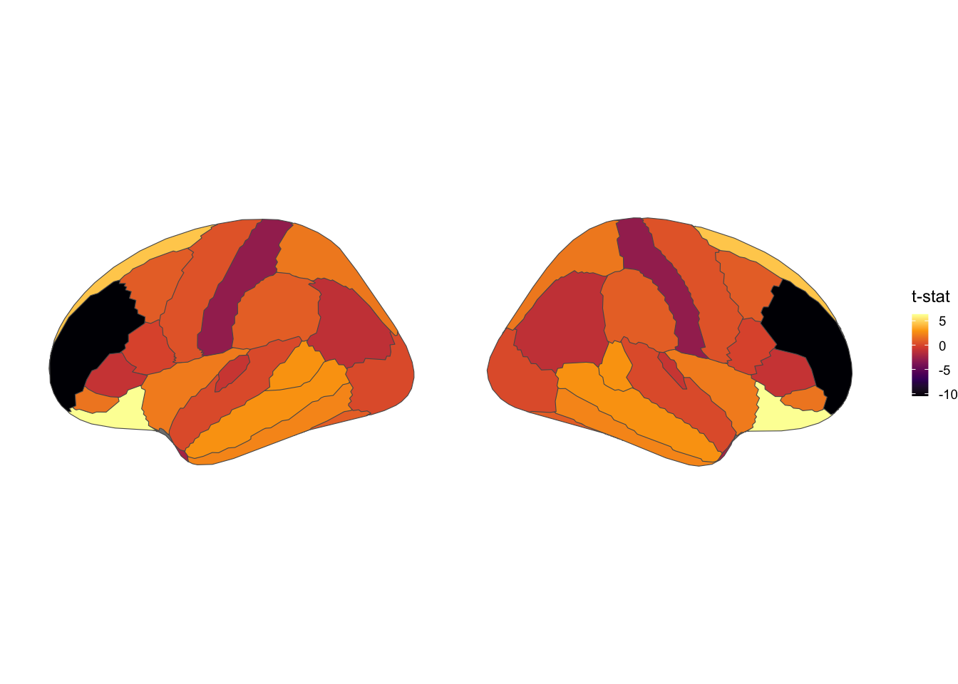 Desikan-Killiany atlas, lateral view, inferno