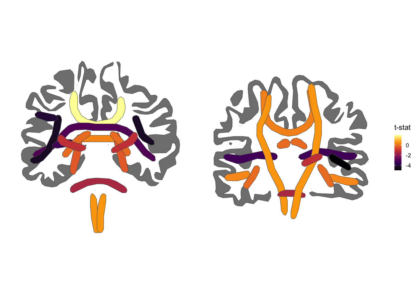 TRACULA atlas, coronal views, inferno