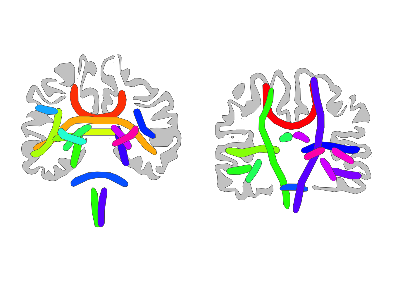 TRACULA atlas, coronal views