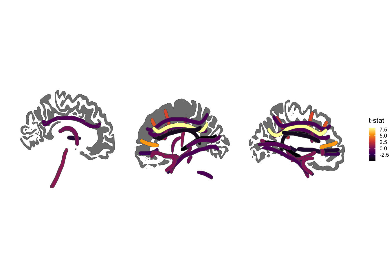 TRACULA atlas, sagittal views, inferno